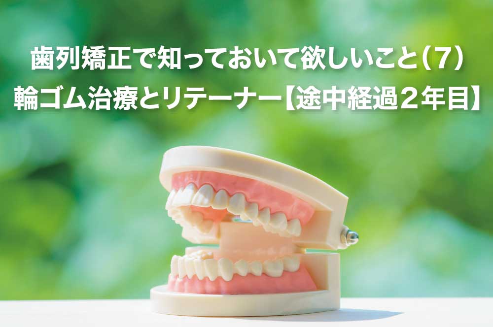 歯列矯正で知っておいて欲しいこと ７ 輪ゴム治療とリテーナー 途中経過２年目